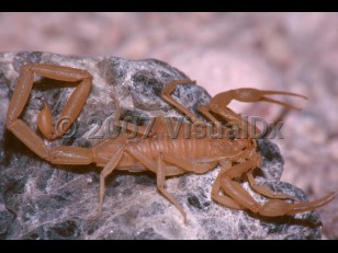 Organism image of Scorpion sting - imageId=3393511. Click to open in gallery.  caption: 'Arizona bark scorpion (<i>Centruroides sculpturatus</i>), Cochise County, Arizona.'